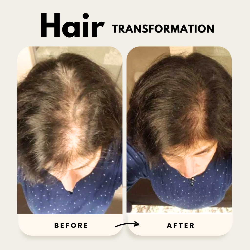 Hair Growth Trio Shampoo Conditioner Oil Set