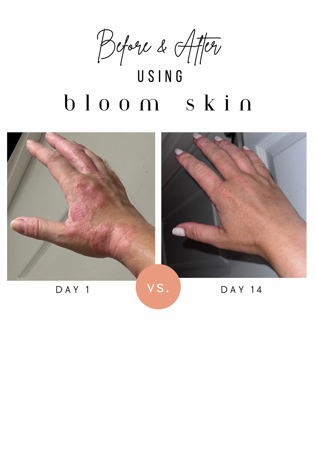 Multipurpose Balm