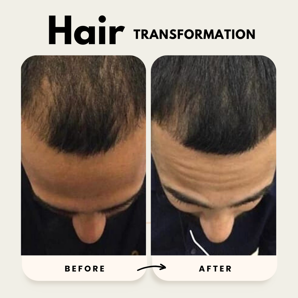 Hair Growth Trio Shampoo Conditioner Oil Set
