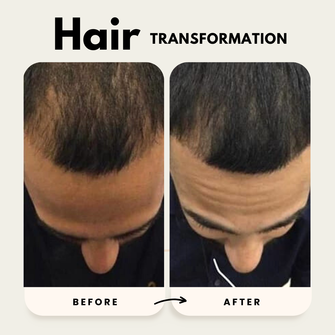 Lustrao Hair Growth Duo| Consistency Kit