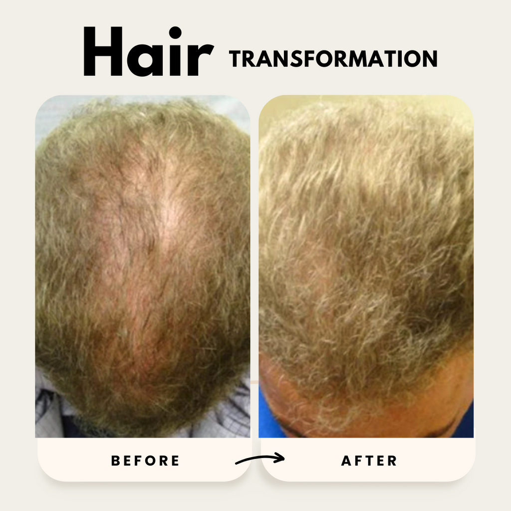 Hair Growth Trio Shampoo Conditioner Oil Set