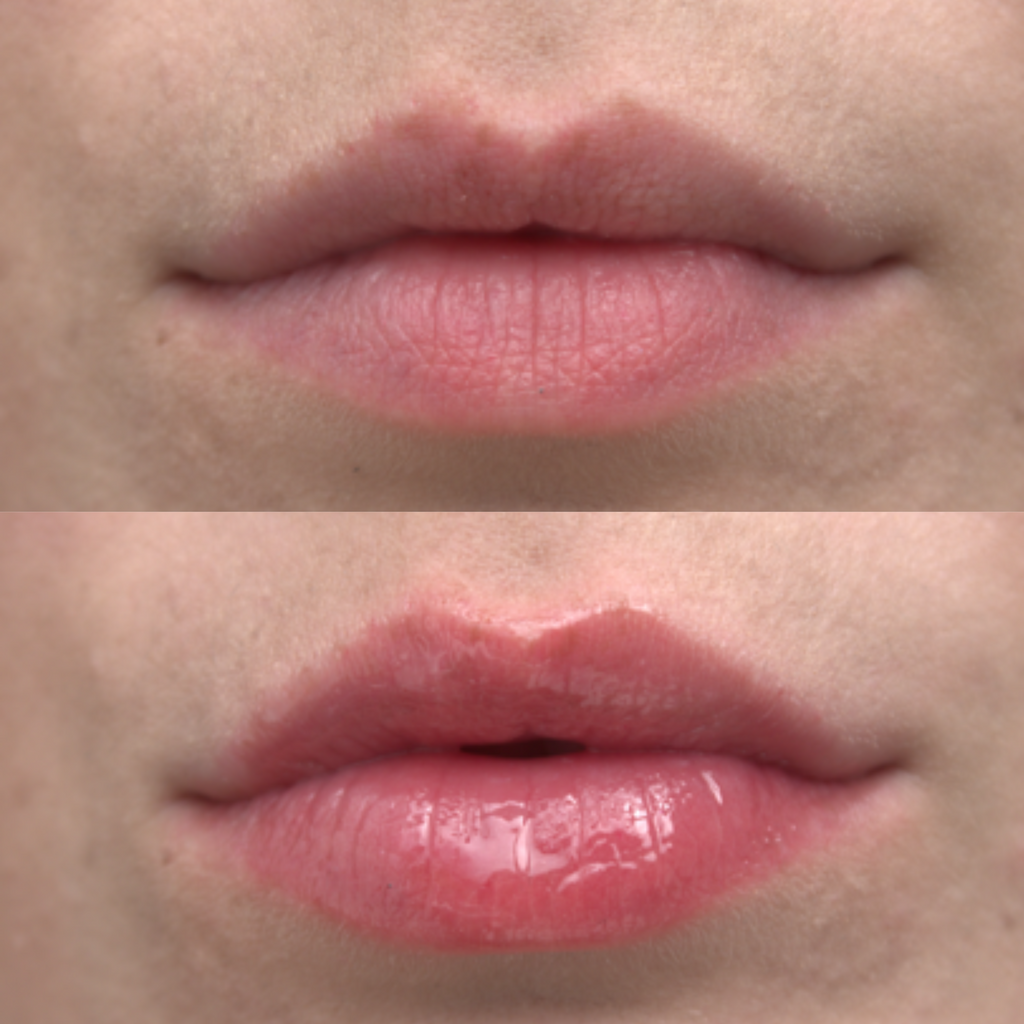 Plump Up The Volume Lip Plumper and Prep