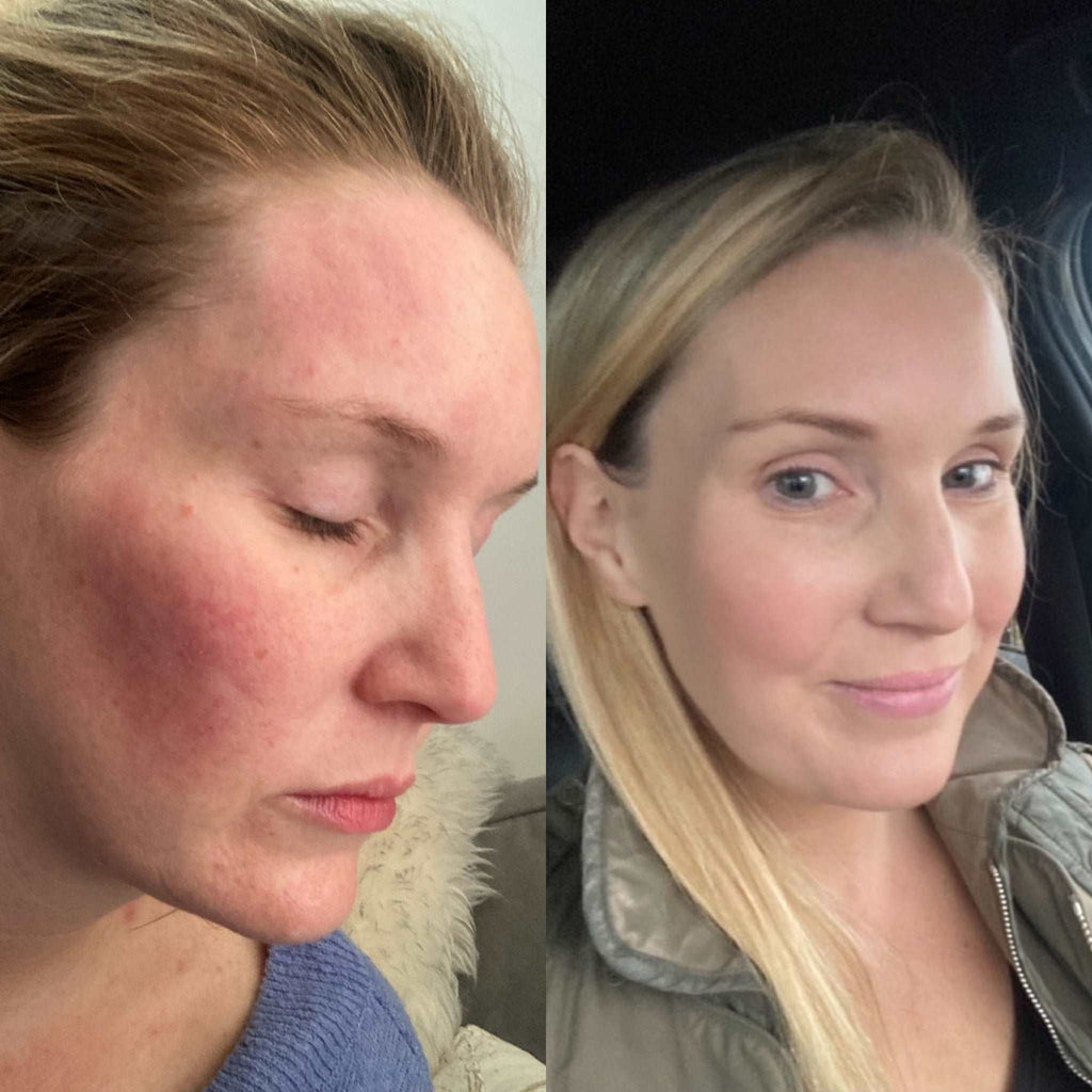 Olive and Avocado Illuminating Skincare Serum 50ml