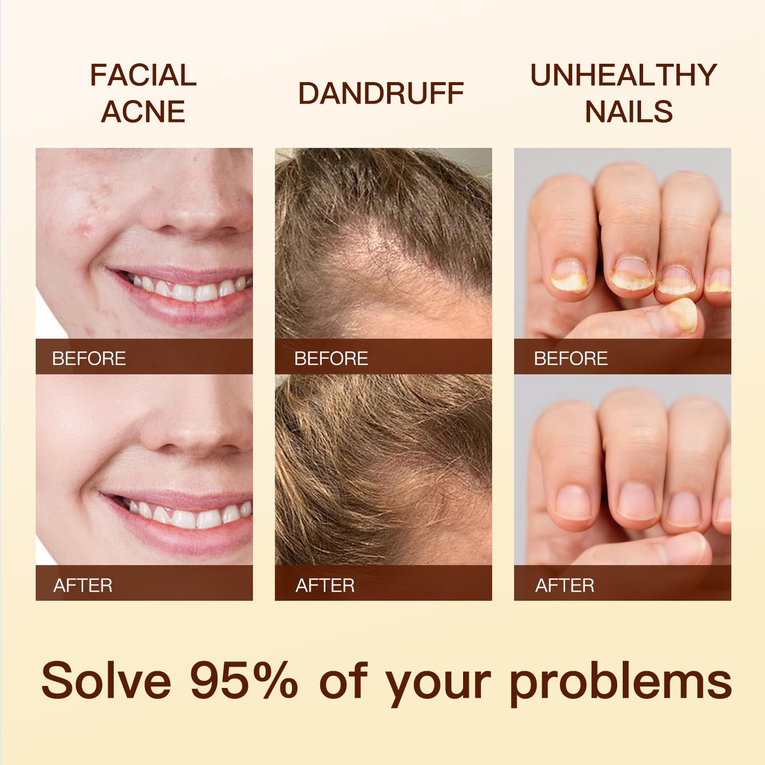 QONG Batana Oil Blend – Hair Growth & Sleep Essential Oil, Scalp Care | 30ml