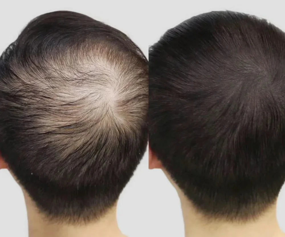 Lustrao Hair regrowth oil